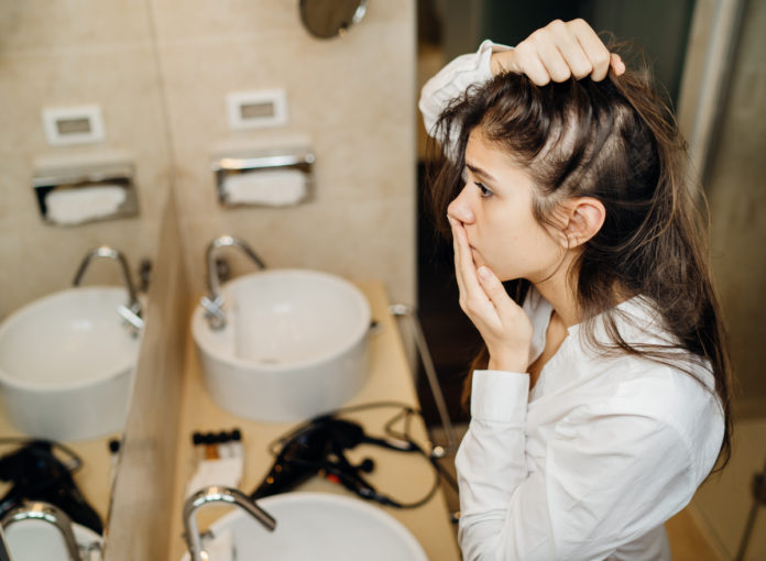 An Haarausfall leiden viele Frauen und Mädchen